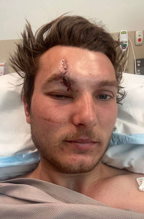 ben-raring-to-go-again-after-scary-chainsaw-accident